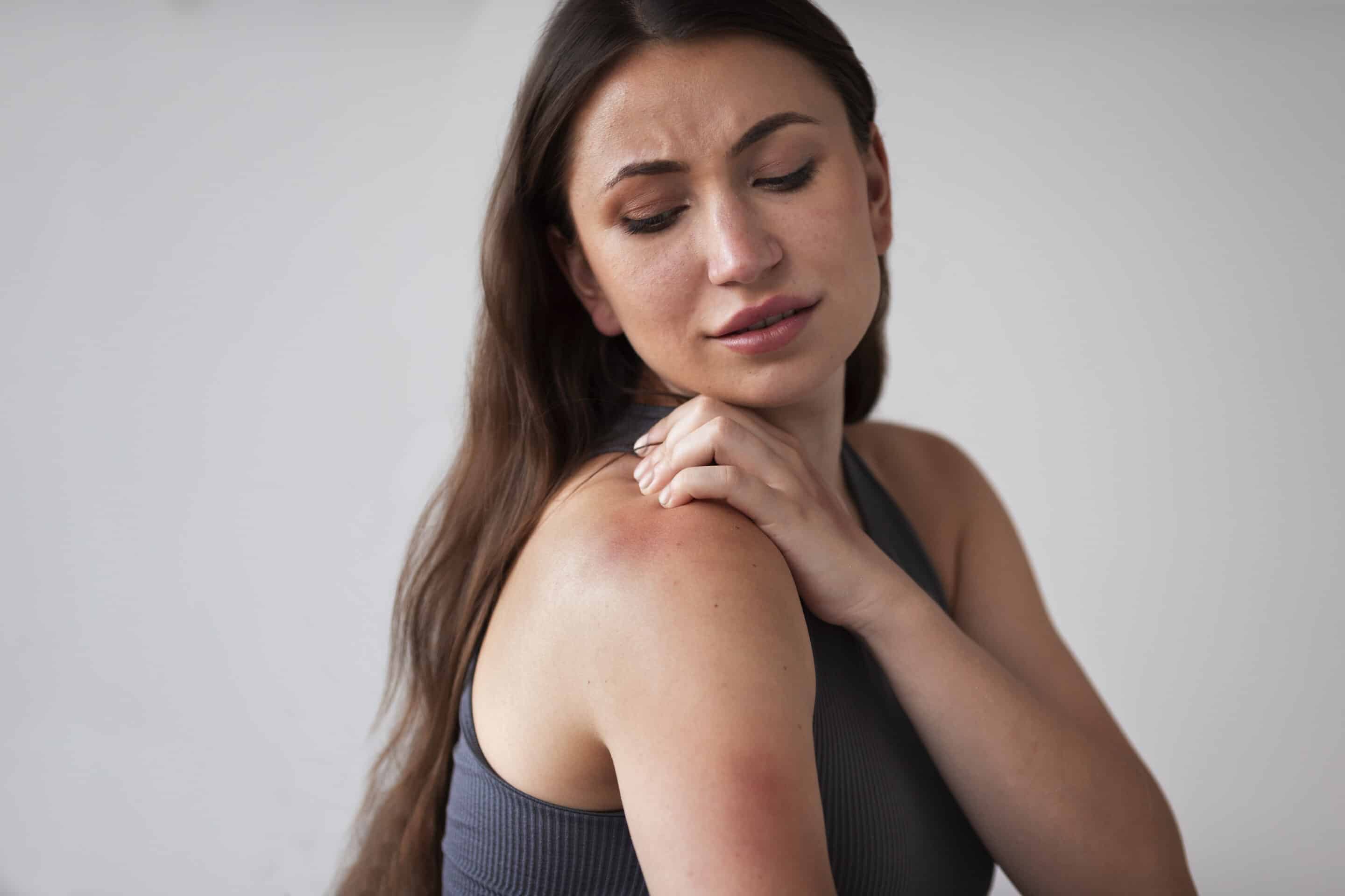 skin-rash-treatment-englewood-cliffs-scherl-dermatology